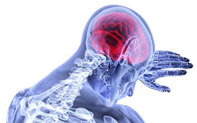 Management of Chronic Concussion Symptoms and Headaches